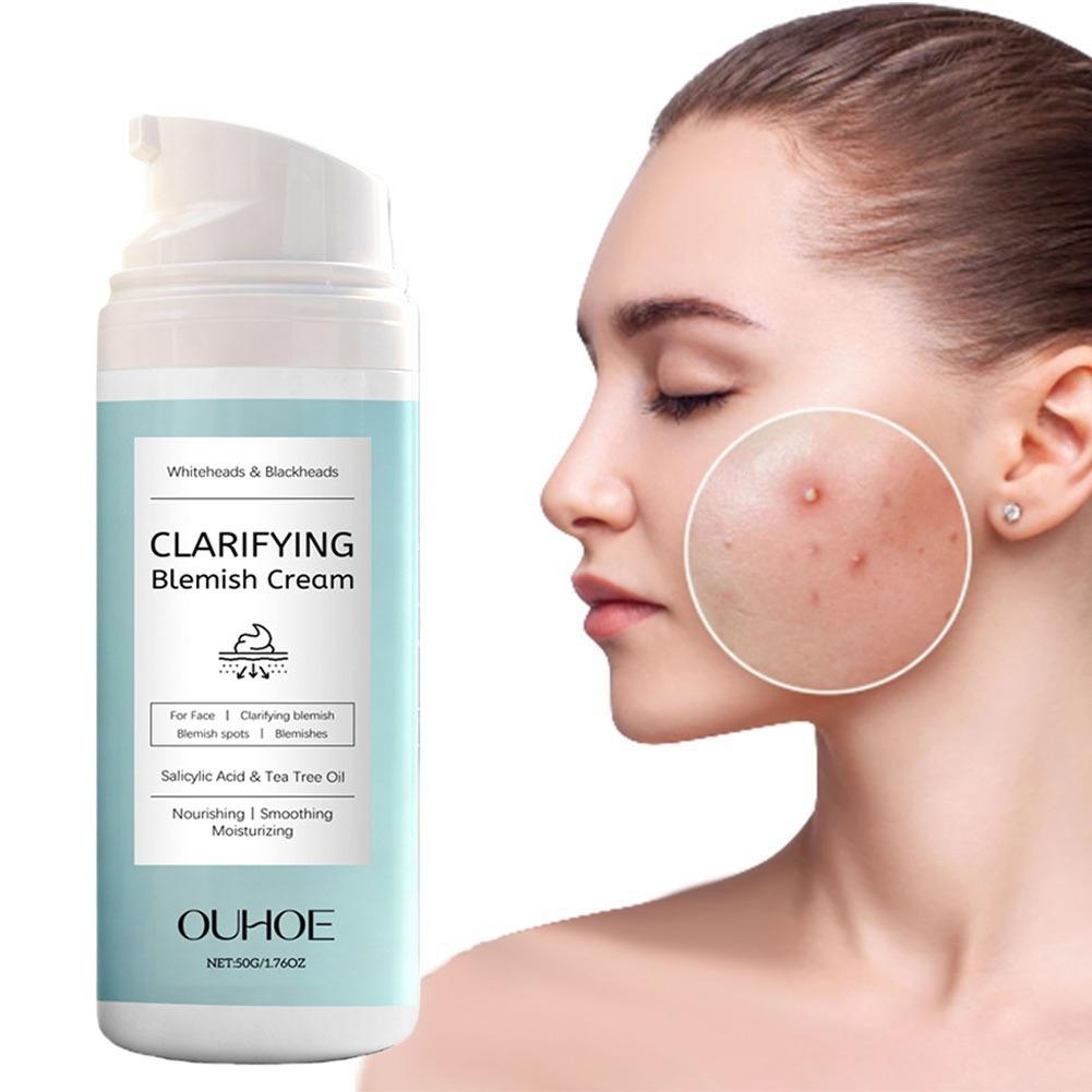 Salicylic Acid Blackhead Remover - Salicylsäure-Akne-Entfernungscreme, pflegende, leichte, nicht fettige Salicylsäure-Creme