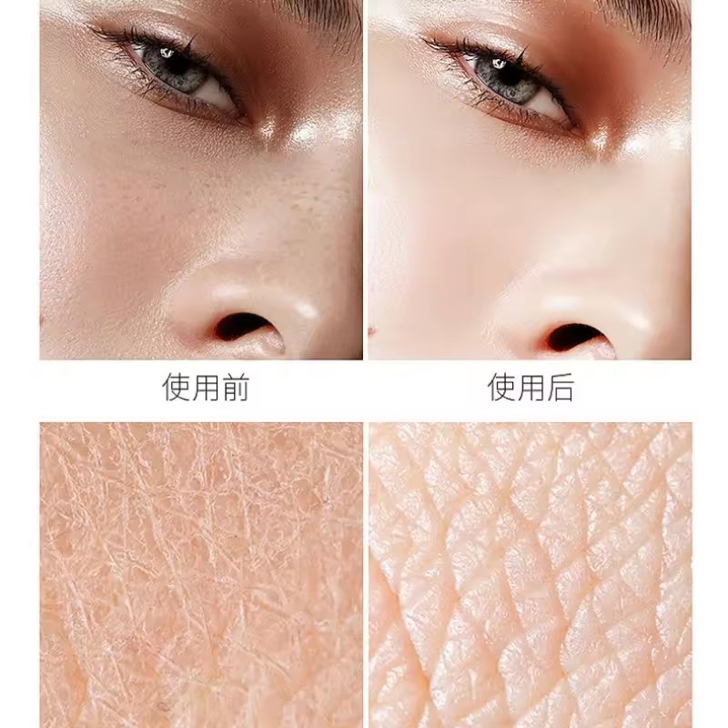 Hyaluronsäure Niacinamid Essen – Niacinamide Pore Shrinking Essence Bewertung und Preis