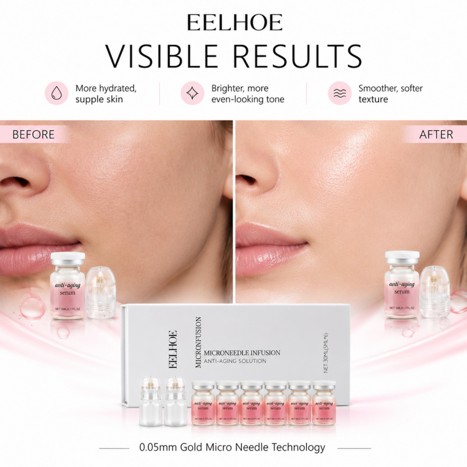 0,2 mm Mikronadel-Serum-Set 6  – Hyaluronic Acid Facial Serum Bewertung und Preis